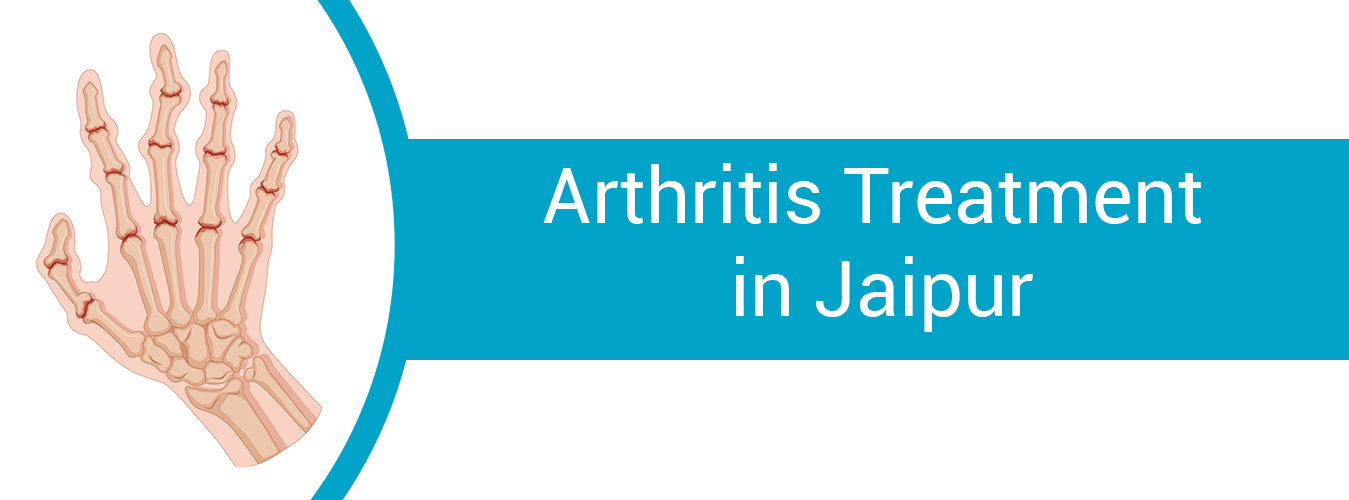 Arthritis Treatment In Jaipur